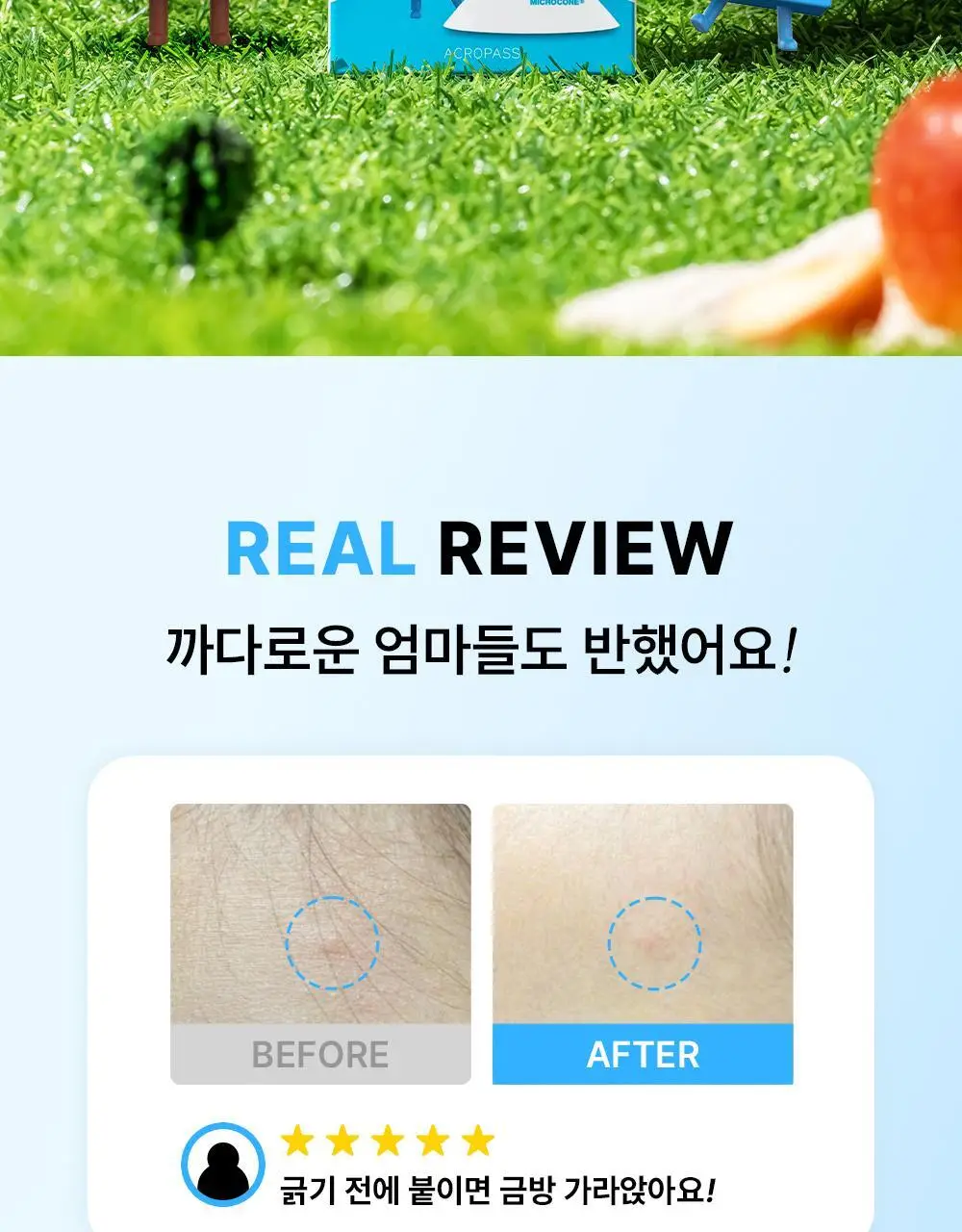 [긁음방지/피부보호] 아크로패스 수딩케어 12매입 상세페이지 2